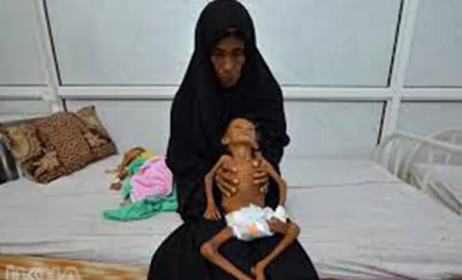 Yemen'de her 10 dakikada bir çocuk ölüyor  