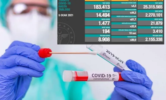 Türkiye'de son 24 saatte Covid-19 kaynaklı 194 ölüm 14 bin 494 tanı kondu 