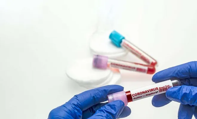 Vaka Sayısı 26 Bini Aştı