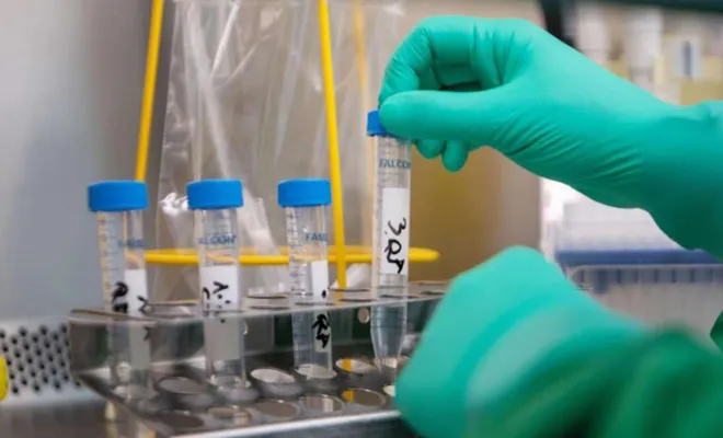 Türkiye'de bir günde 23 bin 731 vaka görüldü 